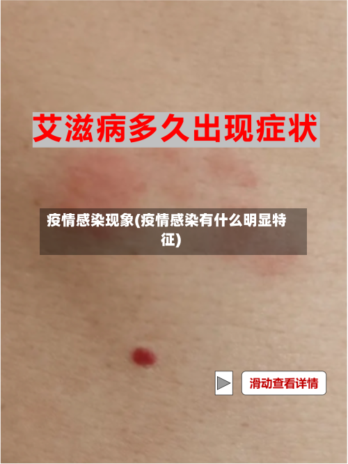 疫情感染现象(疫情感染有什么明显特征)-第1张图片